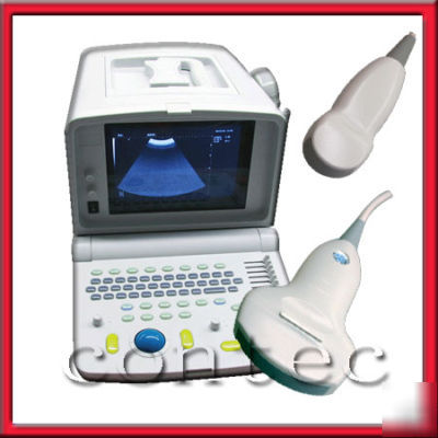  portable ultrasound scanner ultrasound 3.5MHZ convex