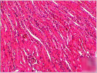 Microscopes usb digital camera, color