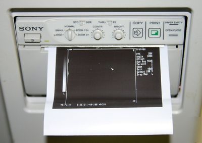 Siemens sonoline prima ultrasound w/ endo-pii probe