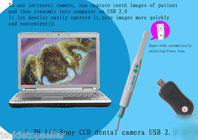 New intraoral intra oral dental camera usb imaging lab